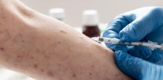 PRIMER CASO DE SARAMPIÓN EN GUANAJUATO ACTIVA PROTOCOLOS SANITARIOS